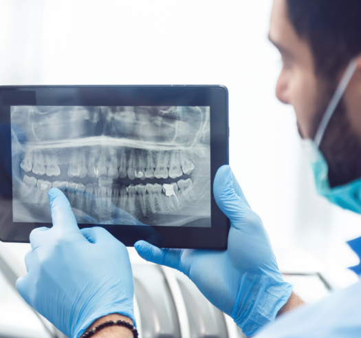 Dentist showing a patient an x ray of their teeth