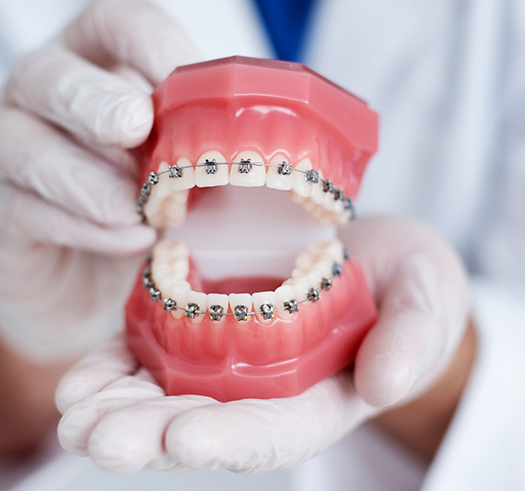 Orthodontist holding a model of the teeth with braces