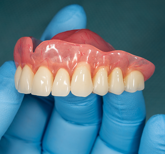 Hand in a latex glove holding a full denture