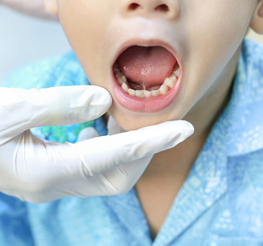 Child opening their mouth wide